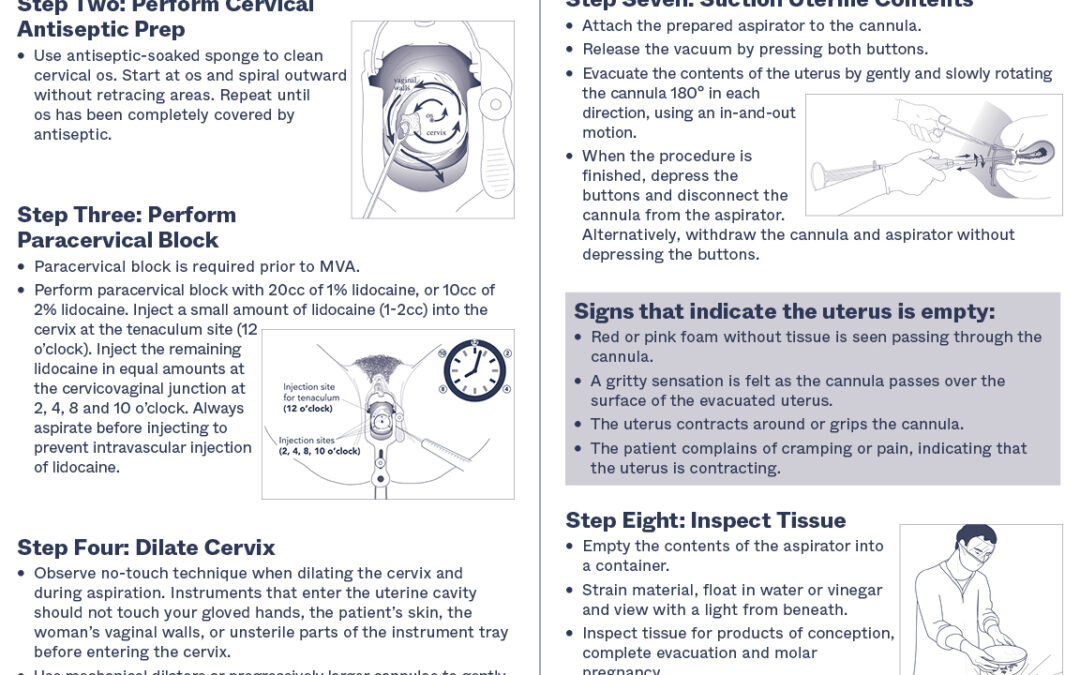 Steps for performing manual vacuum aspiration using the Ipas MVA Plus® and EasyGrip® cannulae